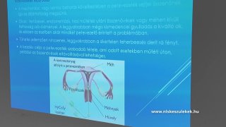 Meddőség, endometriózis kezelése NLSsel