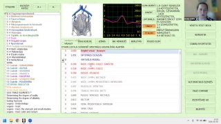 NLS Biophilia Tracker X5 ULTRA alap gépkezelési szeminárium 7.
